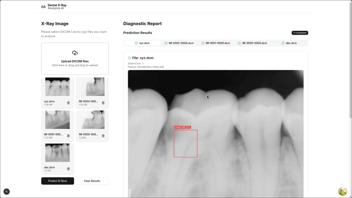 Dental X-Ray Analysis AI cover image